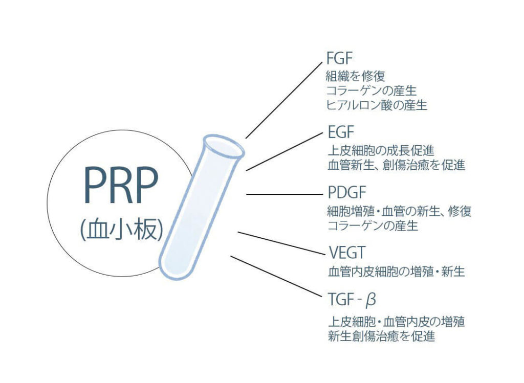 多血小板血漿（PRP）の効果